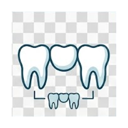 Dental Bridges